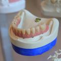 Common Questions About Gum Disease