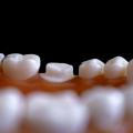 Tips on Finding the Right Dentistry in Austin and Round Rock