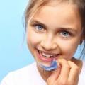 Popular Types of Orthodontic Treatments by Grinz Orthodontics