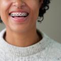 What Orthodontists Won't Tell You