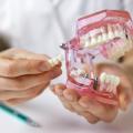 The Cost of Dental Bridges