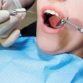 How Do Dentists Clean Teeth?