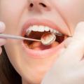 How Do Dentists Clean Teeth?