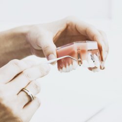 Finding the Right Dentist in Germany: Tips and Tricks